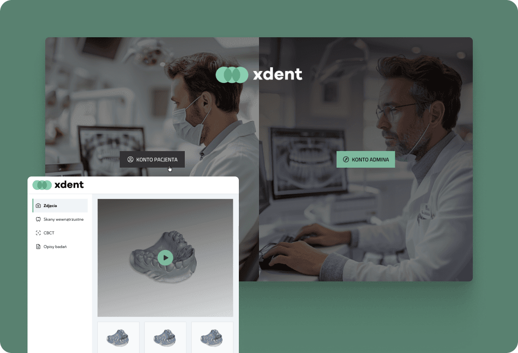 xDent